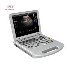 Doppler Cardiac Portable Laptop Ultrasound Machine Medical Cheapest 3D/4D Color Electric Ce 15 Inch LED Medicinal Monitor 128